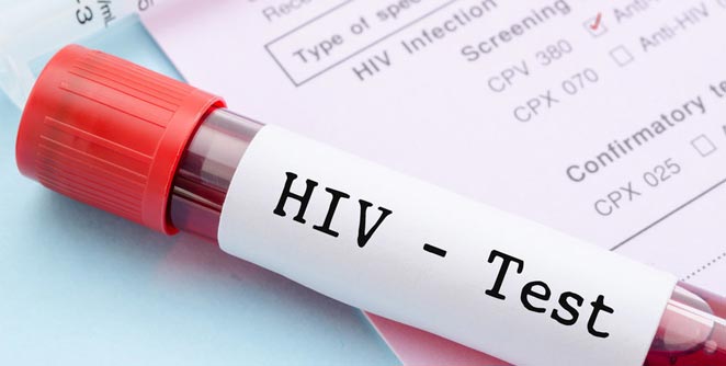 http://vsnews.co.in/upload/2018-02-07/27839165hiv.jpg